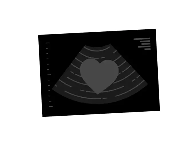 Date Of Diagnosis : 诊断日期