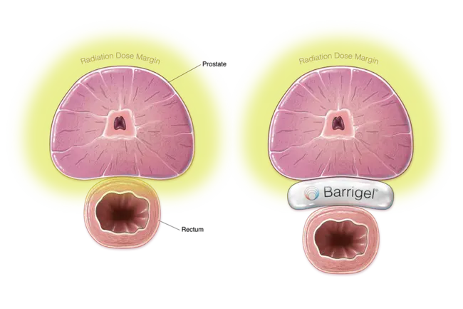 Mens Oncology Research Education : 男性肿瘤研究教育