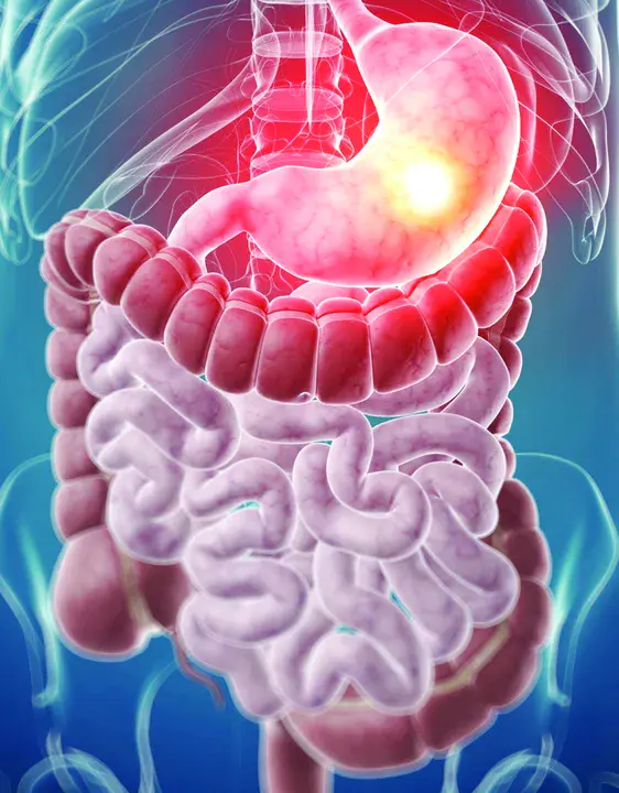 Enteric Cytopathic Human Orphan : 肠细胞病孤儿