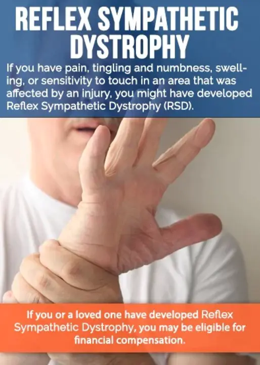 Reflex Sympathetic Dystrophy Syndrome : 反射性交感神经营养不良综合征