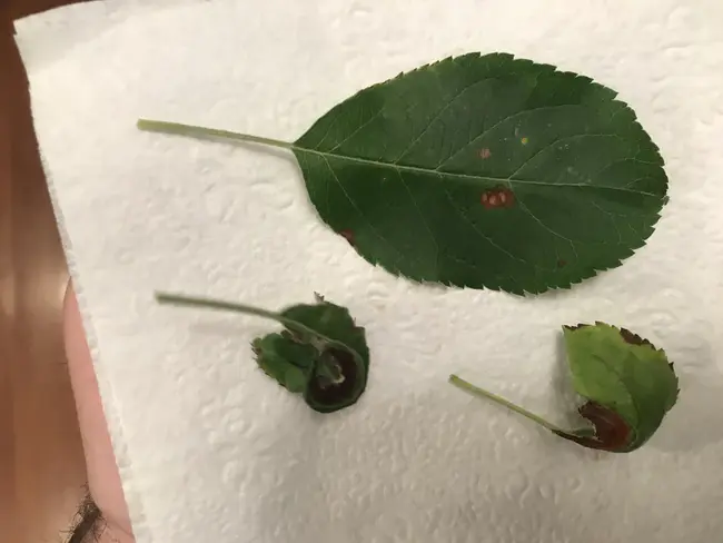 Spinal Cord Injuries and Diseases : 脊髓损伤与疾病