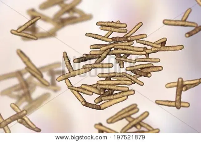 Mycobaterium Avium Intercellure : 中肠肌软化症细胞间