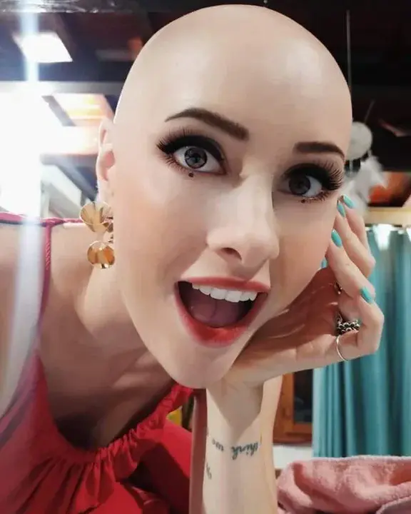 Bald Girl : 秃头女孩