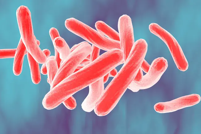 Tuberculosis A Bacterial : 结核A细菌