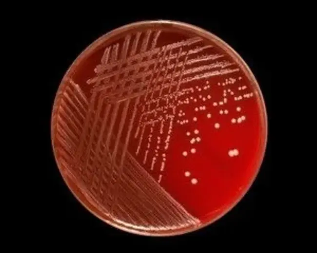 Transmission X-ray Microscope : 透射X射线显微镜