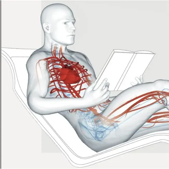 Vascular BrachyTherapy : 血管近距离放射治疗