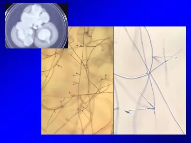 Verticillium, Fusarium, And Nematode : 黄萎病、镰刀菌和线虫病