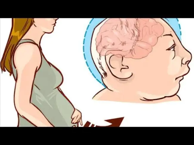 Teratology Society : 畸形学协会