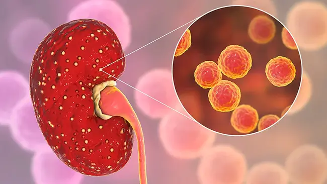 Pyelonephritis Associated Pilus : 肾盂肾炎相关皮毛