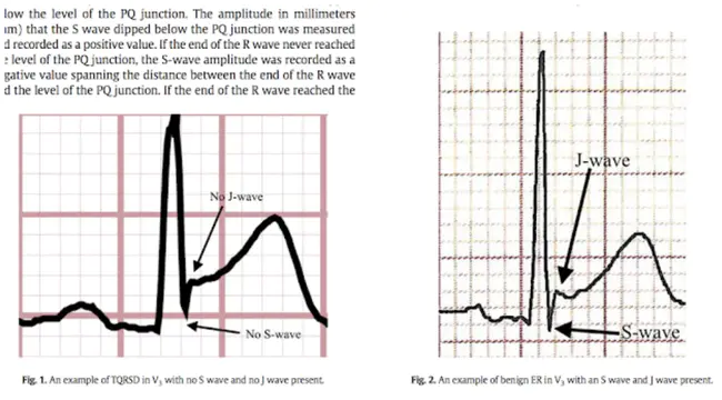 Fourth-order Inter-Modulation Distortion : 第四阶互调失真