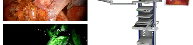 Laser Induced Fluorescence Endoscopy : 激光诱导荧光内窥镜检查