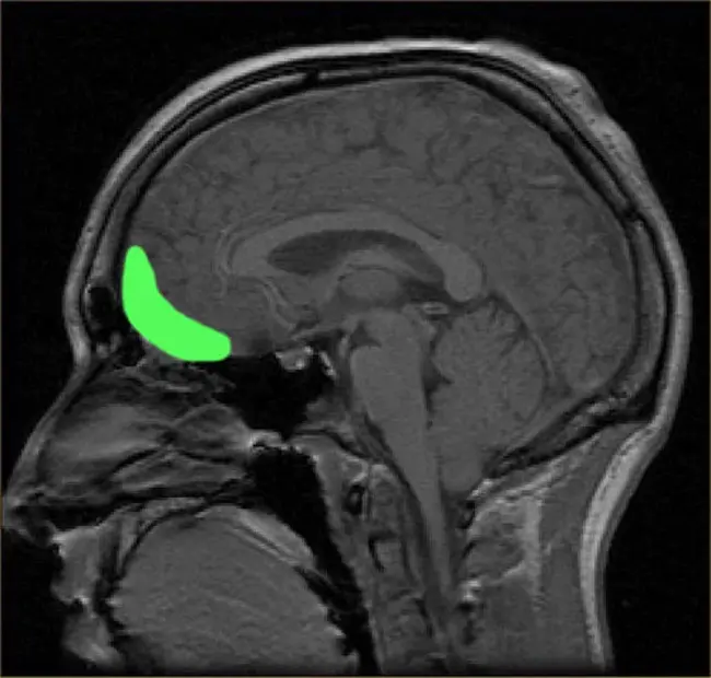 Orbito-Frontal Cortex : 眶额皮质