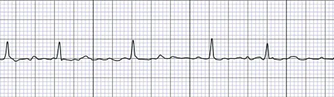 Virtual Interactive Patient Electronic Record : 虚拟交互式患者电子病历