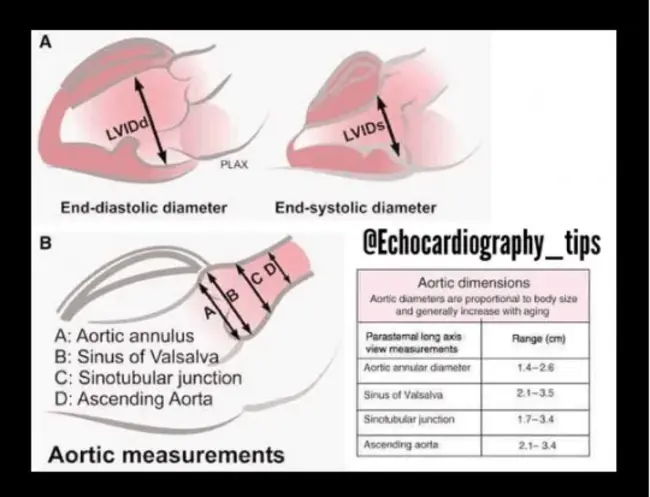 Aortic Diameter : 动脉直径