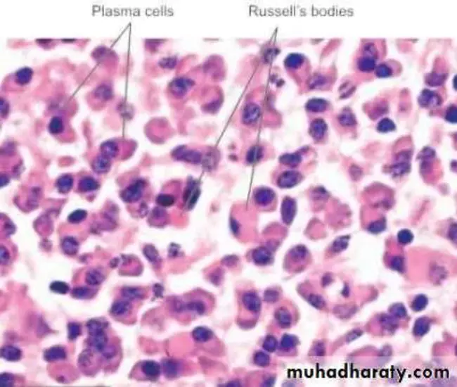 Hyaline Membrane Disease : 透明膜病