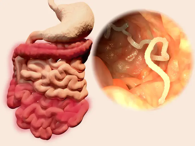 Parasite Virus Disease : 寄生虫病毒病