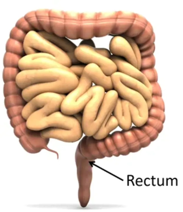 Rectuum Invited Party : Rectuum邀请派对