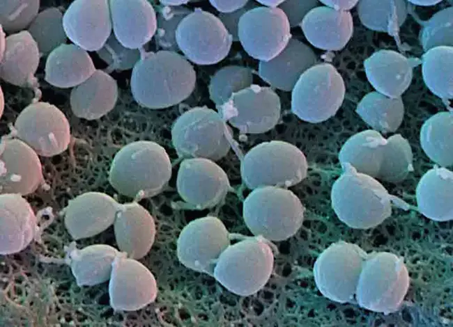 Staphylococcus Aureus : 金黄色葡萄球菌