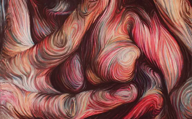 Tardive Dyskinesias : 迟发性运动障碍