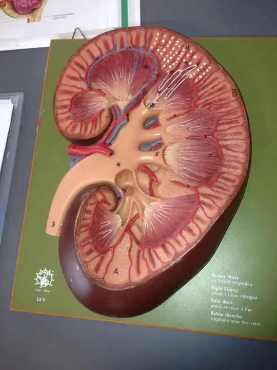 Urinary Analysis : 尿路分析