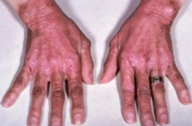 Pelagra Preventing : 防雷电