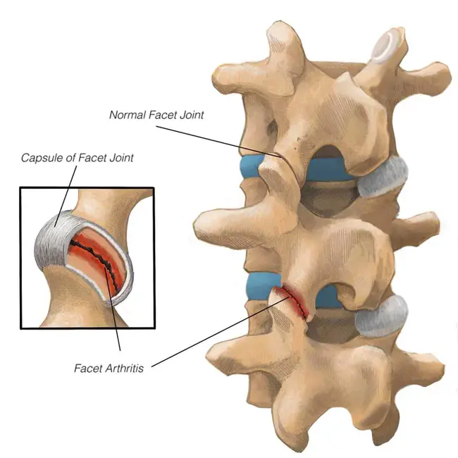 Back And Joints : 背关节