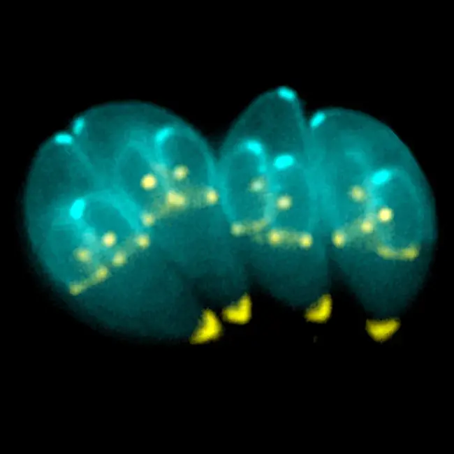 Toxoplasma Gondii : 弓形虫