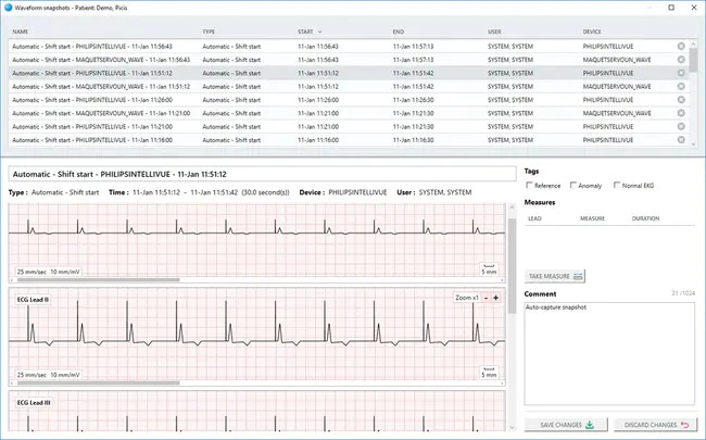 Waveform Surge Error : 波形浪涌误差