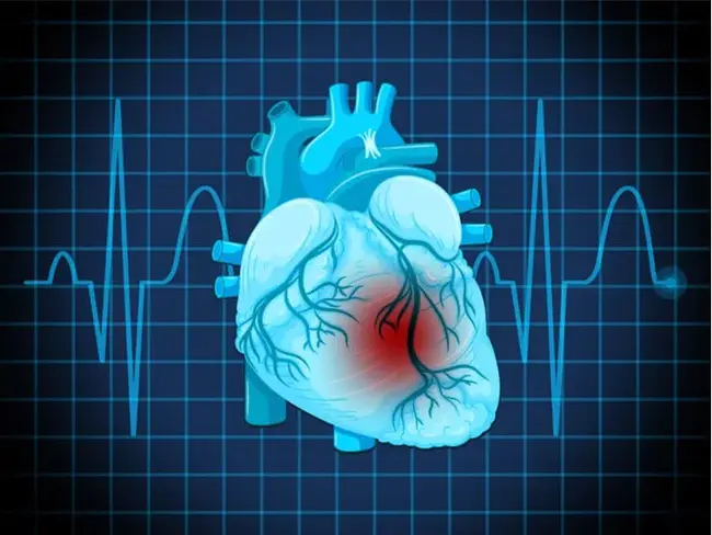 Familial Dilated Cardiomyopathy : 家族性扩张型心肌病