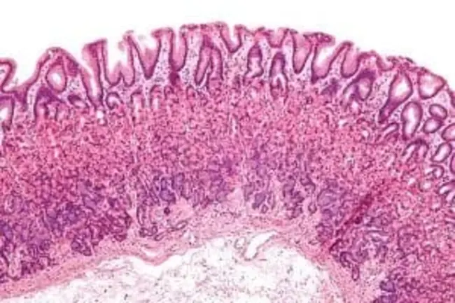 Mucosa Associated Lymph Tissues : 粘膜相关淋巴组织