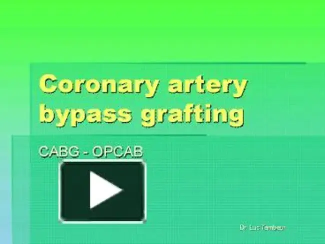 Coronary Artery : 冠状动脉