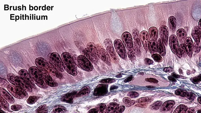 Proximal Inter Phalanx : 指骨近端