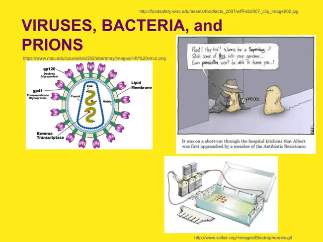 Human Immunodeficiency Virus Gum problems : 人体免疫缺陷病毒性牙龈问题