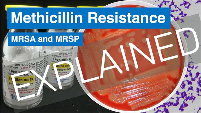 Methicillin Resistant S Aureus : 耐甲氧西林金黄色葡萄球菌