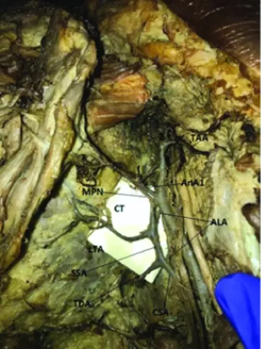 Dorsal Digital Artery of Thumb : 拇指指背动脉