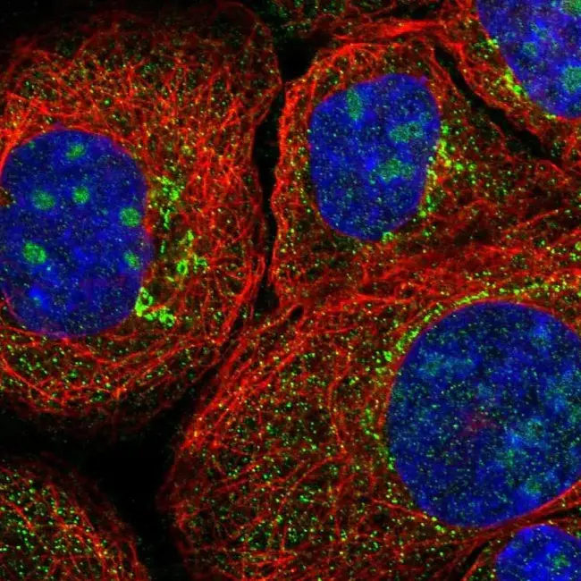 CaThepSin K gene : 组织蛋白酶K基因