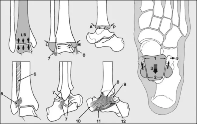 Posterior Talar Impingement Syndrome : 距骨后撞击综合征