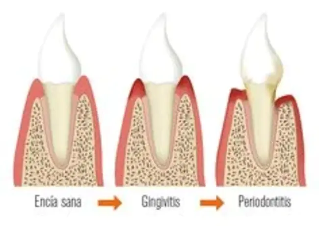 Austrian Association for Periodontal Research : 奥地利牙周研究协会