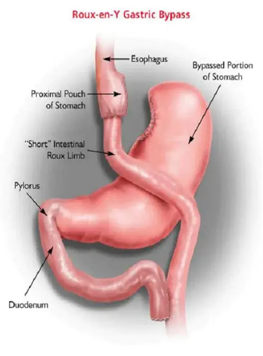 Gastric Medical Operation : 胃内科手术