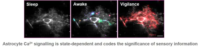 Astrocyte-Conditioned Medium : 星形细胞条件培养基