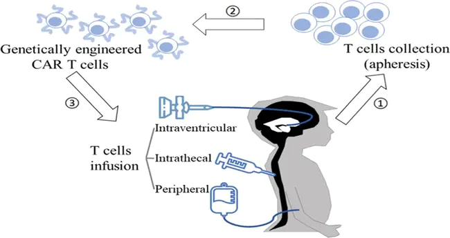 Human Anti-Chimeric Antibody : 人抗嵌合抗体