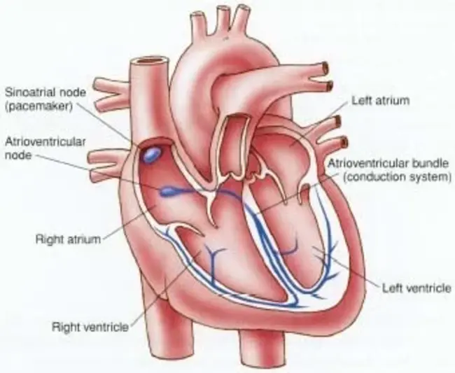 Sinoatrial Nasal Dysfunction : 窦房鼻功能障碍