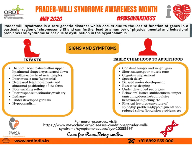 Prader-Willi Syndrome : 普瑞德威利综合症