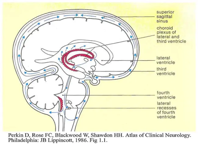 IntraCerebroBentricular : 脑室内