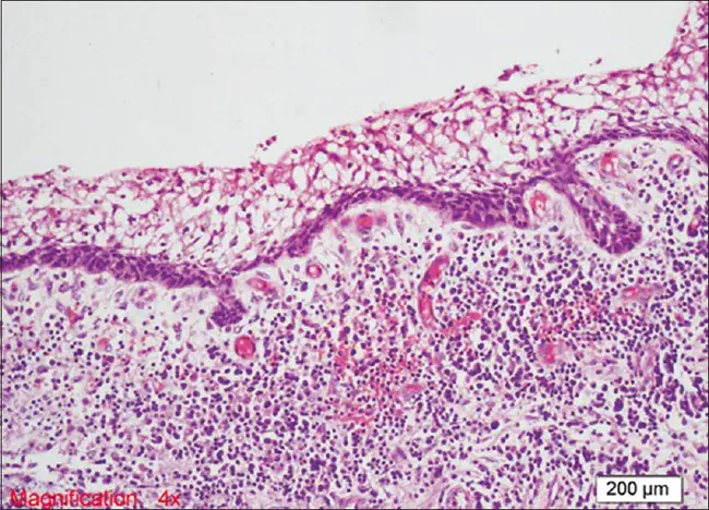 Histopathologic Basis Of Disease : 病理组织学基础