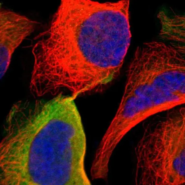 Adenosine DeAminase : 腺苷脱氨酶