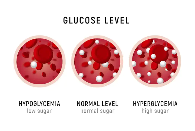 Fasting Insulin-Glucose Product : 空腹胰岛素葡萄糖产物