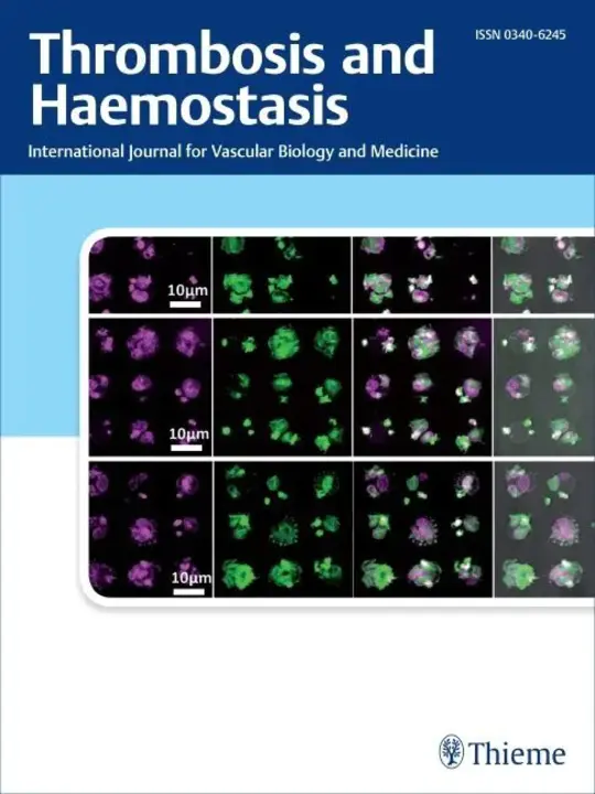 ThrombElastoGraph Hemostasis System : 血栓成形术止血系统