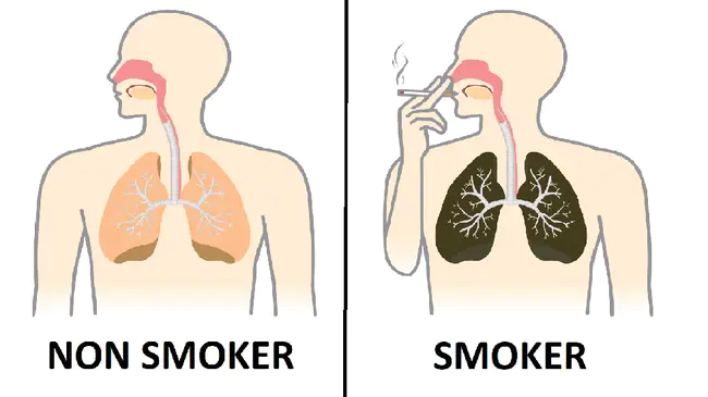 Non-Smokers : 不吸烟者