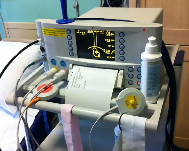 CardioTocoGraph : 心脏分娩力描记器